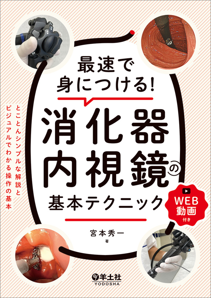 最速で身につける！消化器内視鏡の基本テクニック〜とことんシンプルな