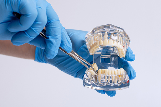 再生療法（歯の移植・再植） - 吉野歯科医院（八潮市八潮）