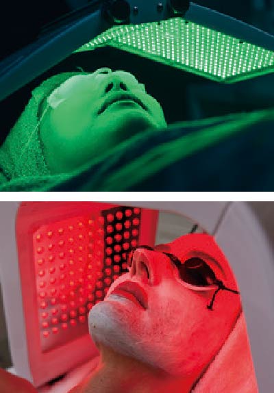 敏感肌でも使用しやすいRF美顔器「フォトプラス EX スムース S」｜YA