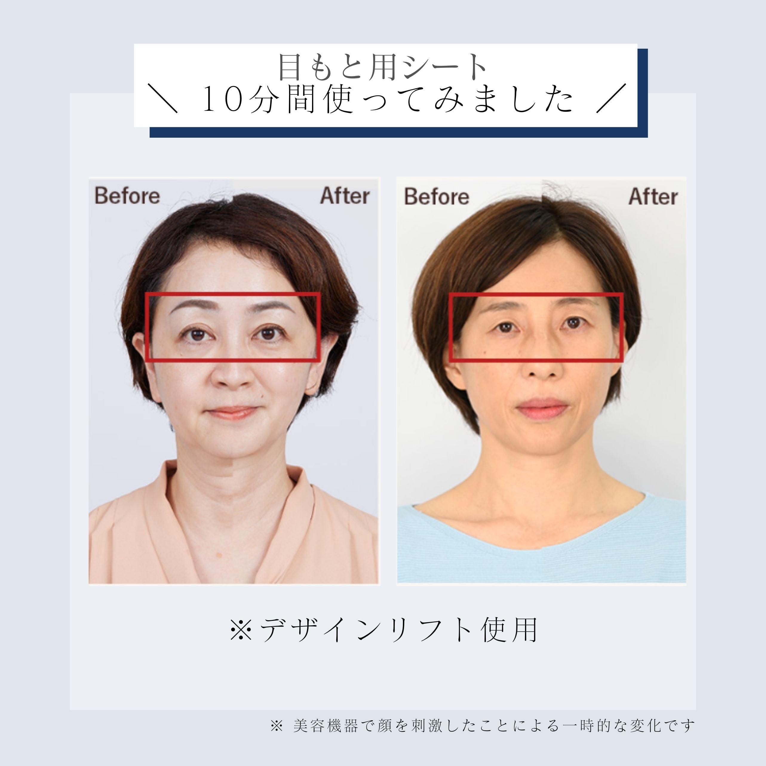 デザインリフトモア目もと集中4ヵ月コースD（C1）｜ヤーマン公式通販