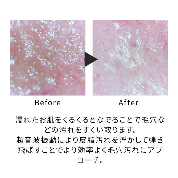 ミーゼ ディープスキンクリア｜ヤーマン公式通販サイト | ヤーマン