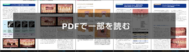 CLINICAL IMPLANT DENTISTRY クリニカル インプラント デンティスト