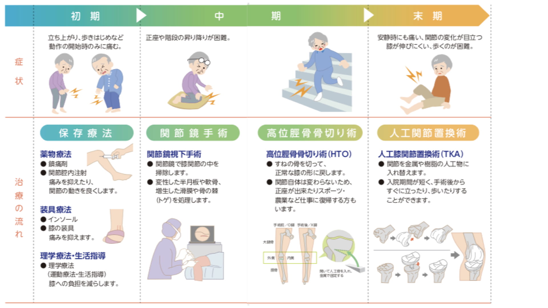 人工膝関節置換術に対するリハビリテーション｜疫学 ｜ XPERT