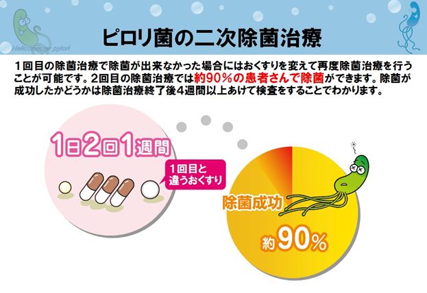 ピロリ菌の除菌治療 | 岩国市尾津町の内科、胃腸科、消化器内科