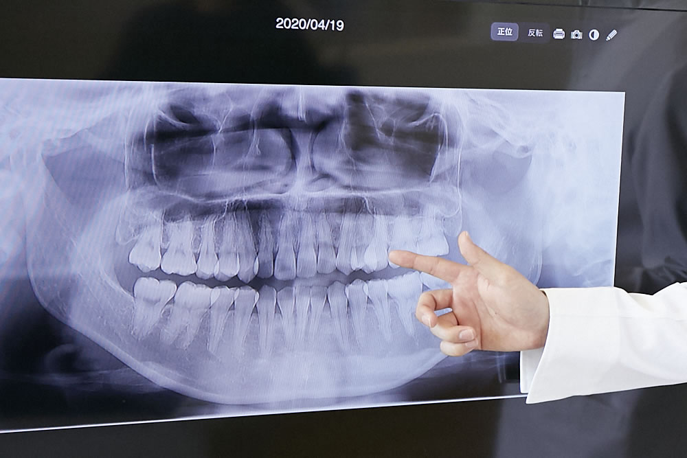 多治見市で矯正歯科なら山内歯科多治見おとなこども矯正へ