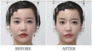 歪みの症例 | はじめての方へ | さつま式®小顔整骨 Myo-Osteopractic