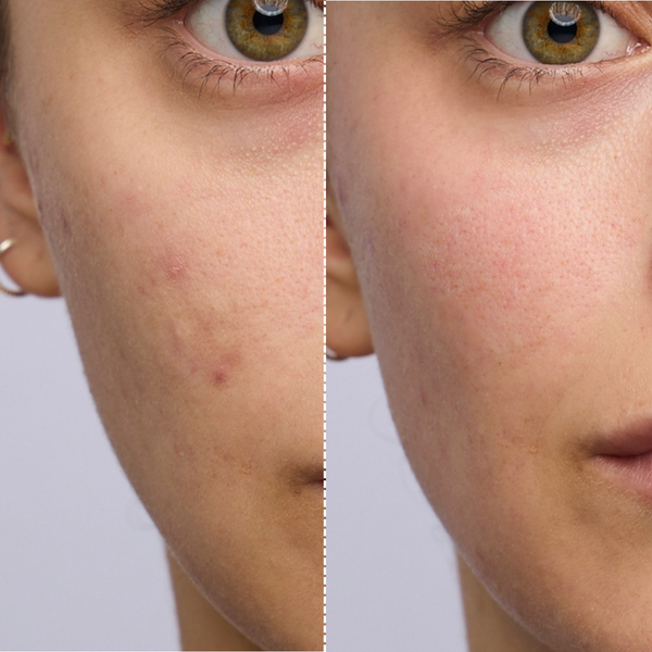 ZIIP | Expert Facials On Demand