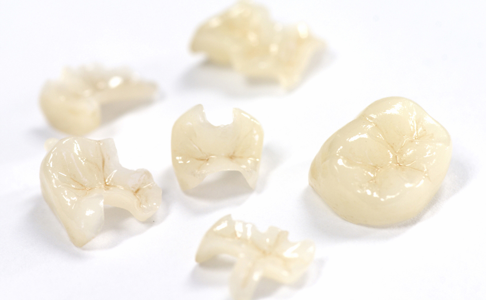 プレスセラミックス - 株式会社足利セラミックラボラトリー