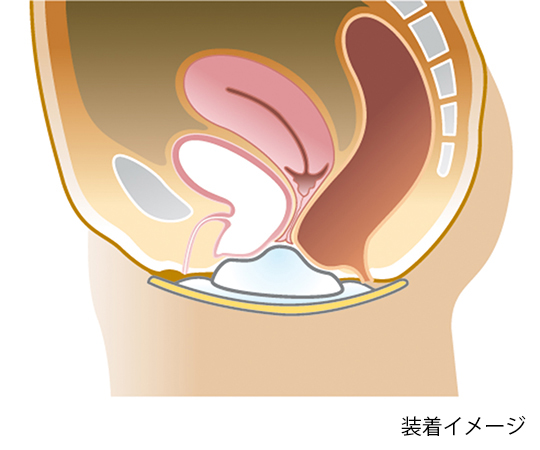 取扱を終了した商品です］フェミクッション スターターキットミニ I
