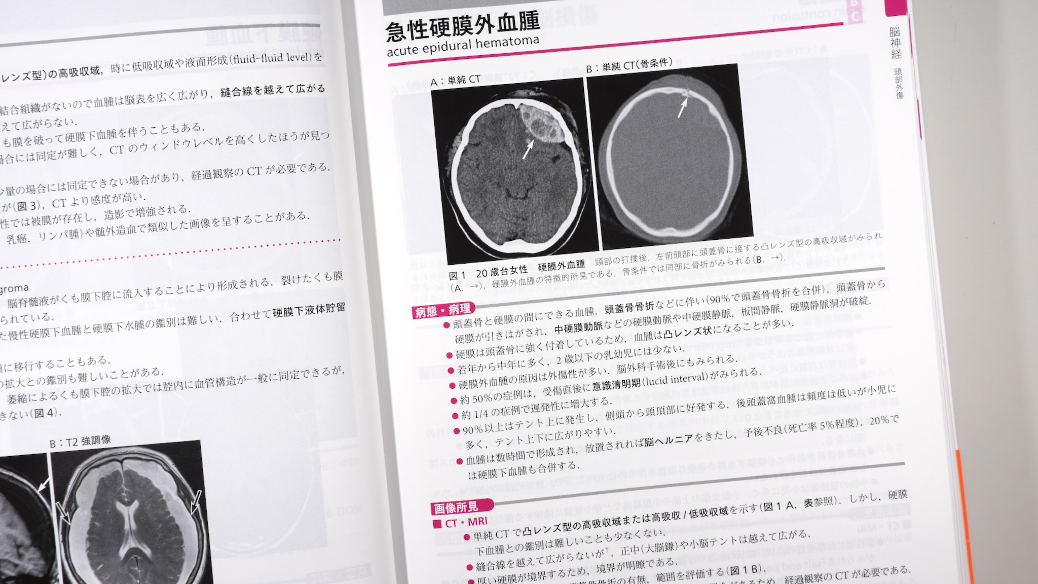 ジェネラリストを目指す人のための画像診断パワフルガイド 第2版