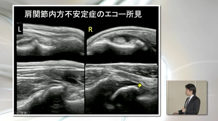 これから始める！犬の運動器エコーテクニック | 株式会社 医療情報研究所