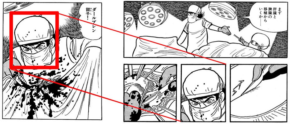 ブラック・ジャック』の封印作品｜イカサマタコサマ