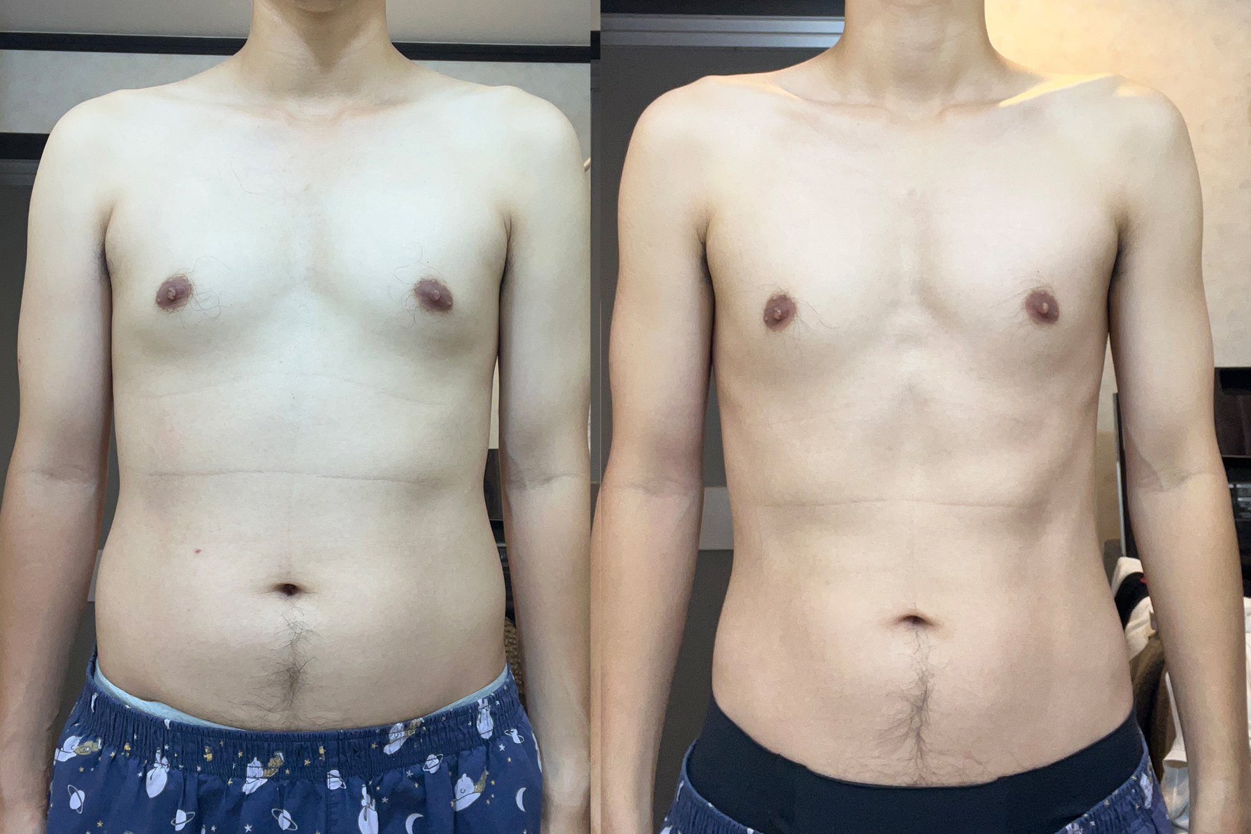 Gemini×ダイエット実験｜AIの言う通りに10週間続けたら腹筋は割れる