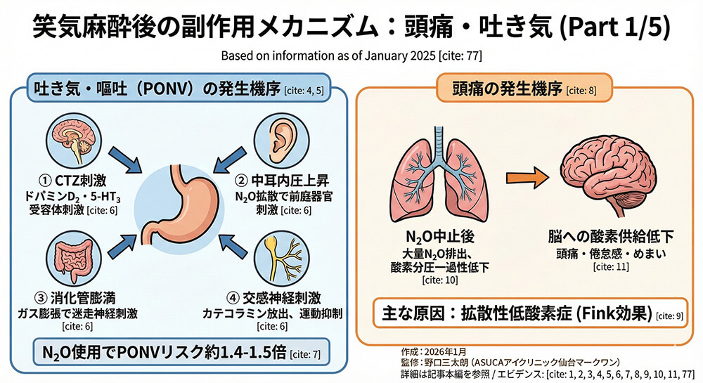 😌 笑気麻酔の副作用（頭痛・吐き気）と対処法👁️ ～眼科手術で笑気