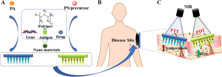 Photothermal therapy - ScienceDirect