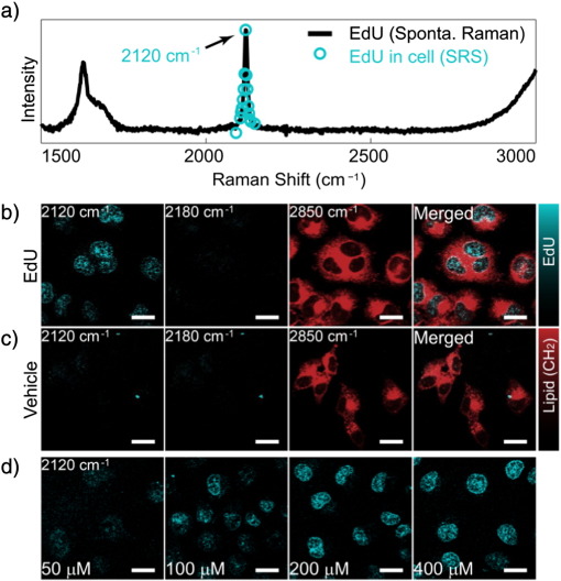 Beyond the borders — Biomedical applications of non-linear Raman