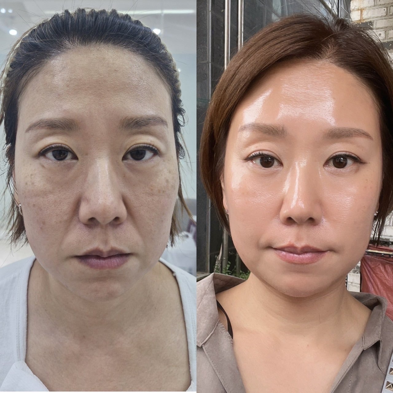 INCELLDERM COLLAGEN 100 MELTING MASK 6ea / インセルダムコラーゲン