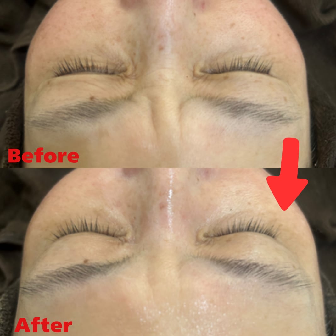 REVIハーブピーリングスターターキット | Dahlia Beaute