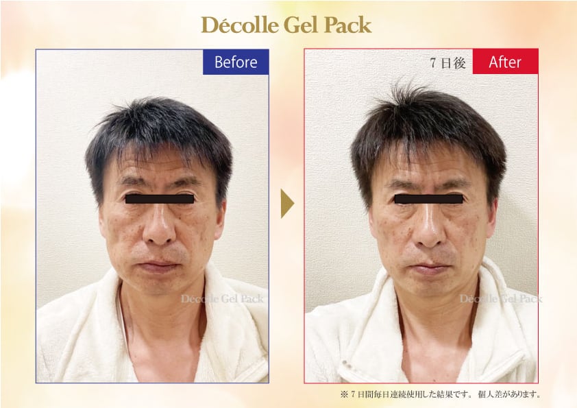 炭酸60分発生【デコールジェルパック10回分】炭酸パック【従来品4倍の