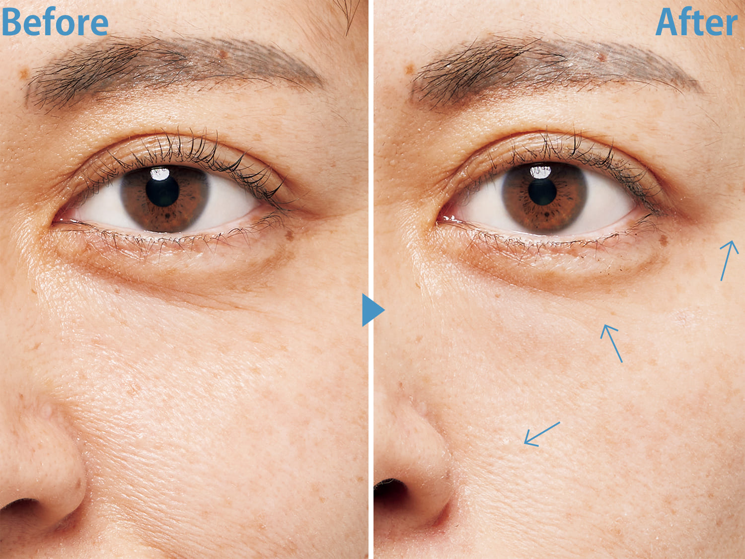 衝撃Before→After3選】シワ改善コスメを読者が2週間本気で使ったら