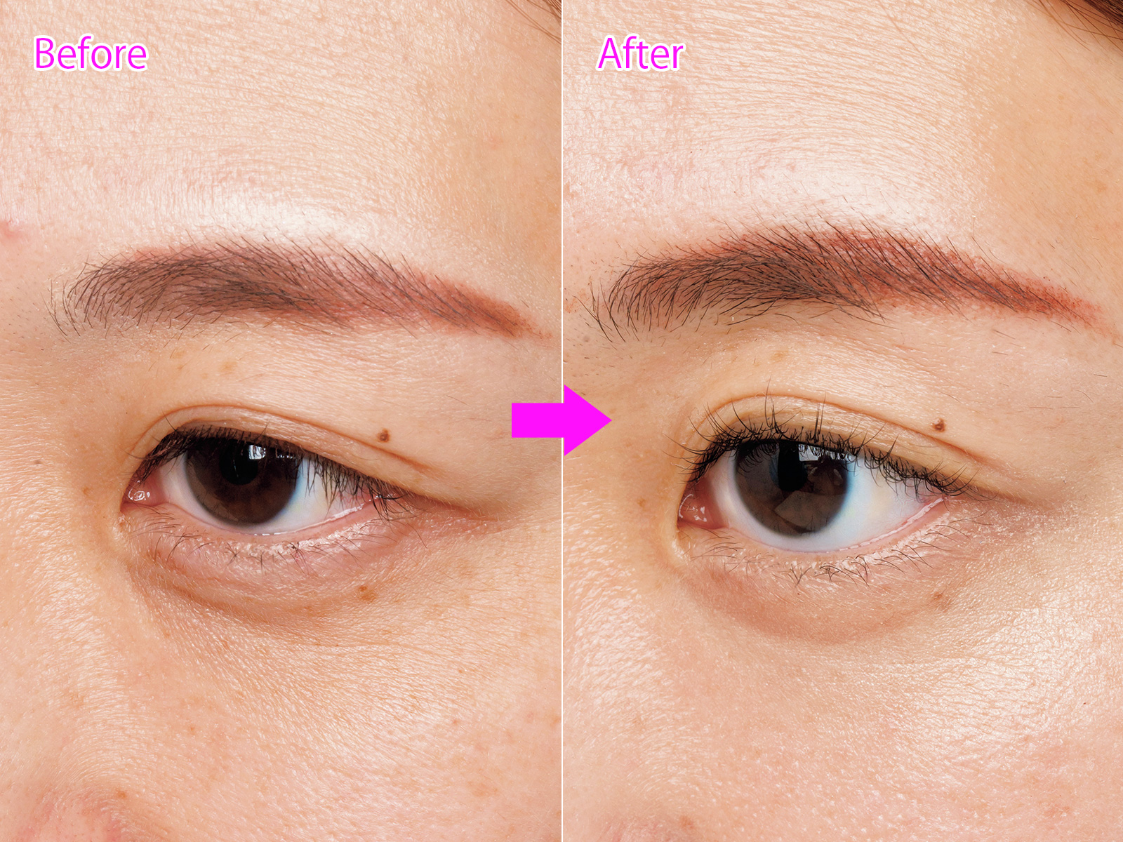 10日間ガチで試した】クマ・シワ・たるみに！“美容医療級アイクリーム