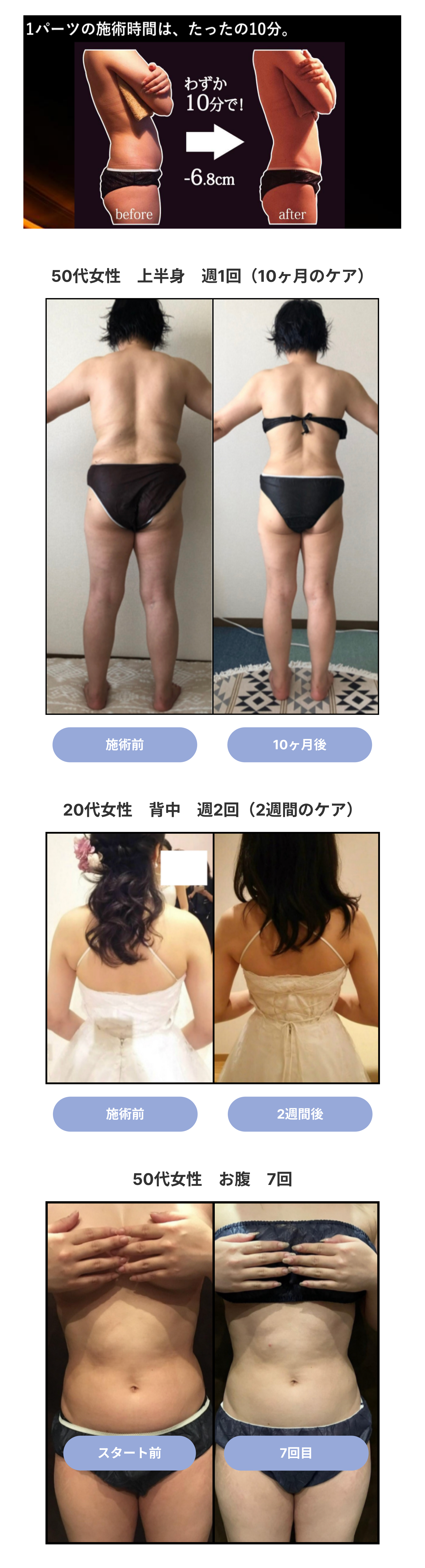 公式】 キャビゼロ痩身 ｜小顔・痩身・美肌ならBeaute / ボーテ