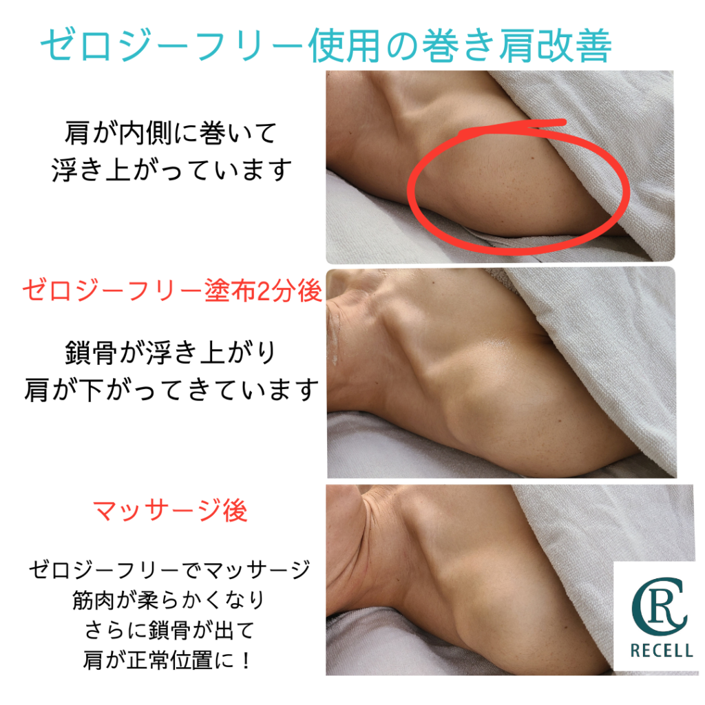 塗るだけダイエット」わずか2分で頑固な脂肪が変わる！ゼロジーフリー |