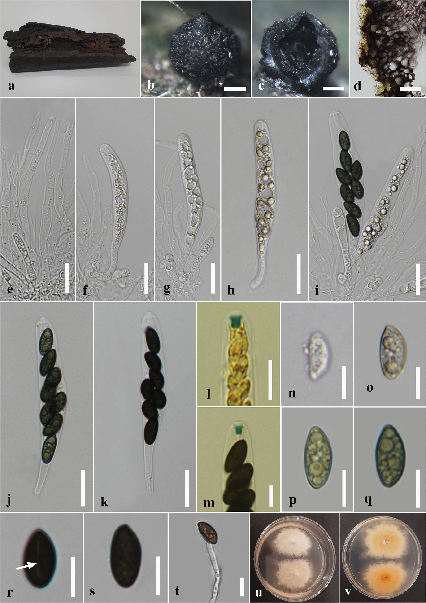 Taxonomy, phylogeny, and bioactive potential of Xylariales