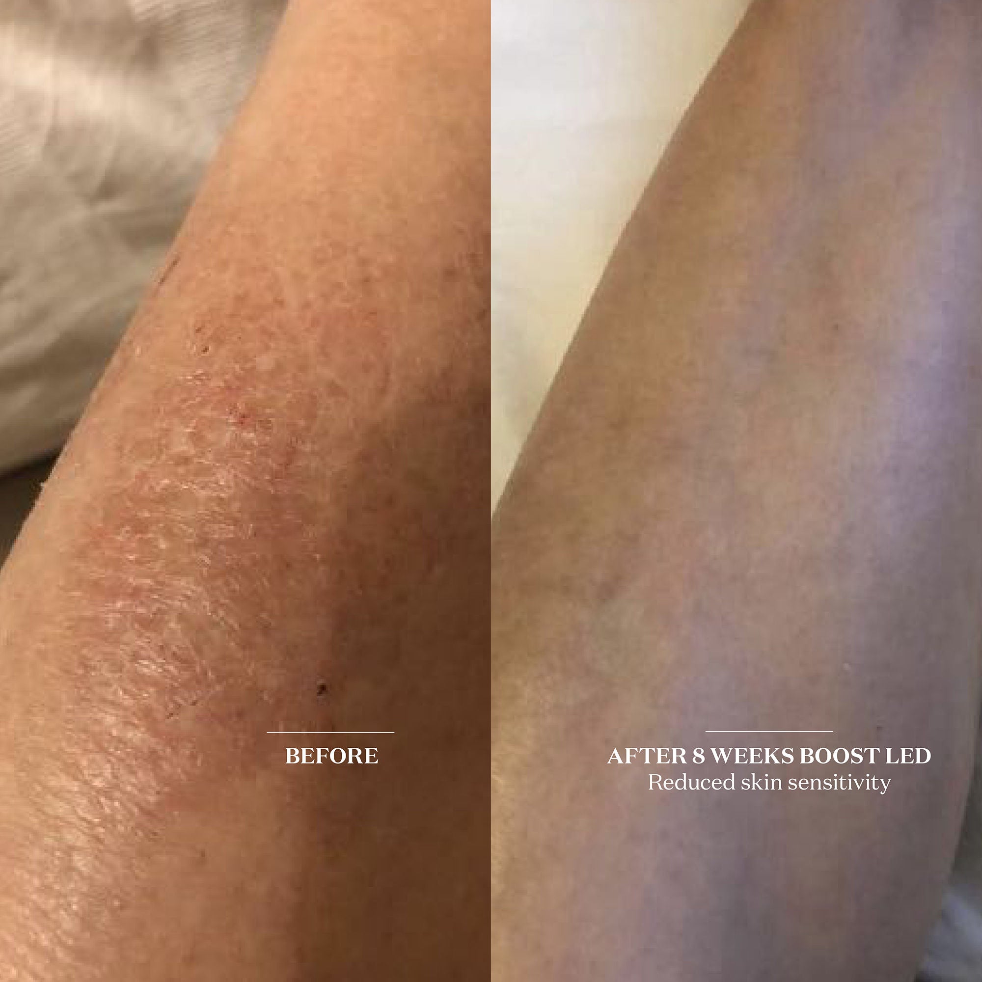 The Light Salon Boost LED Patch – The Light Salon – bluemercury