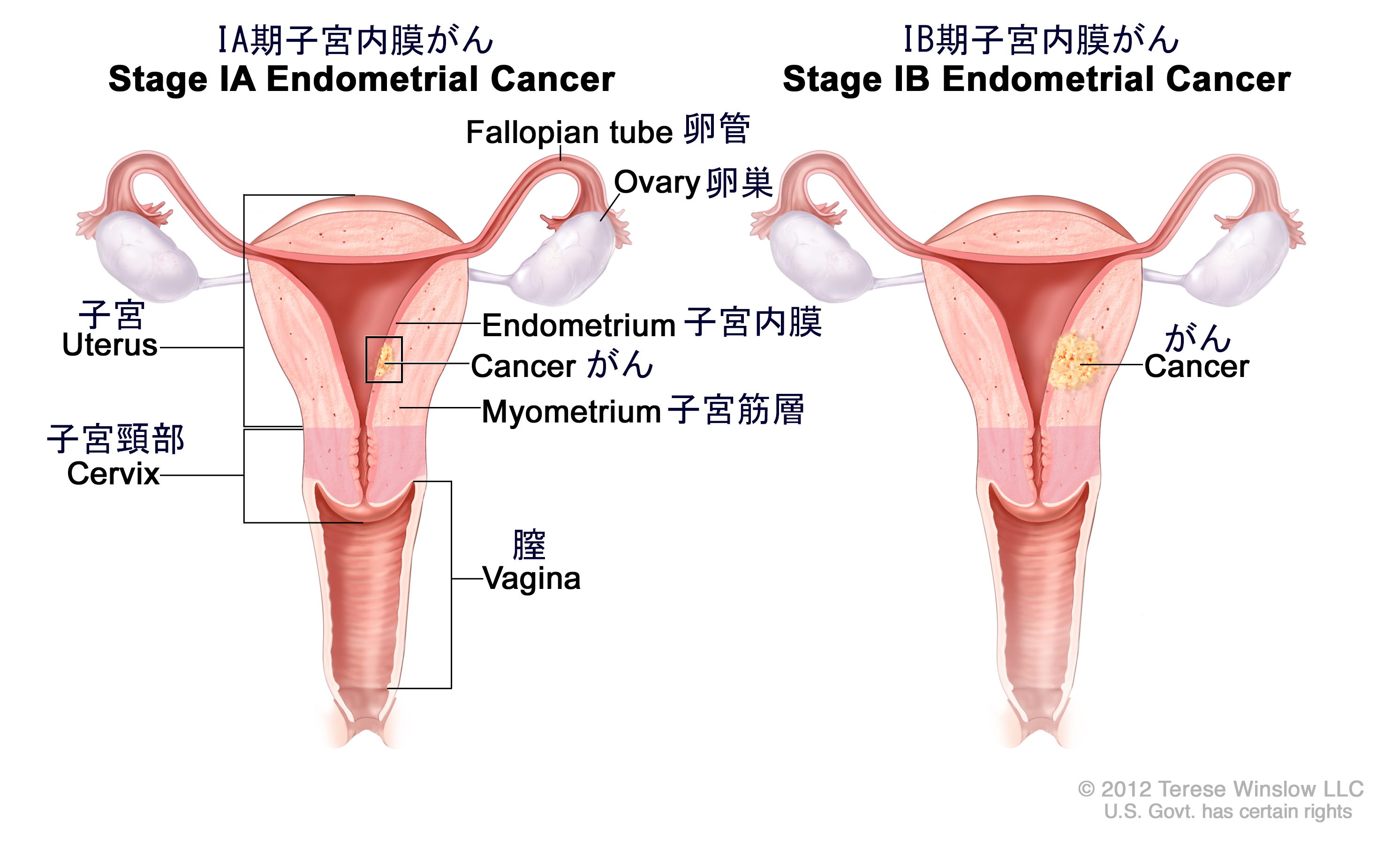 がん情報サイト | がん情報各論：[医療専門家向け]