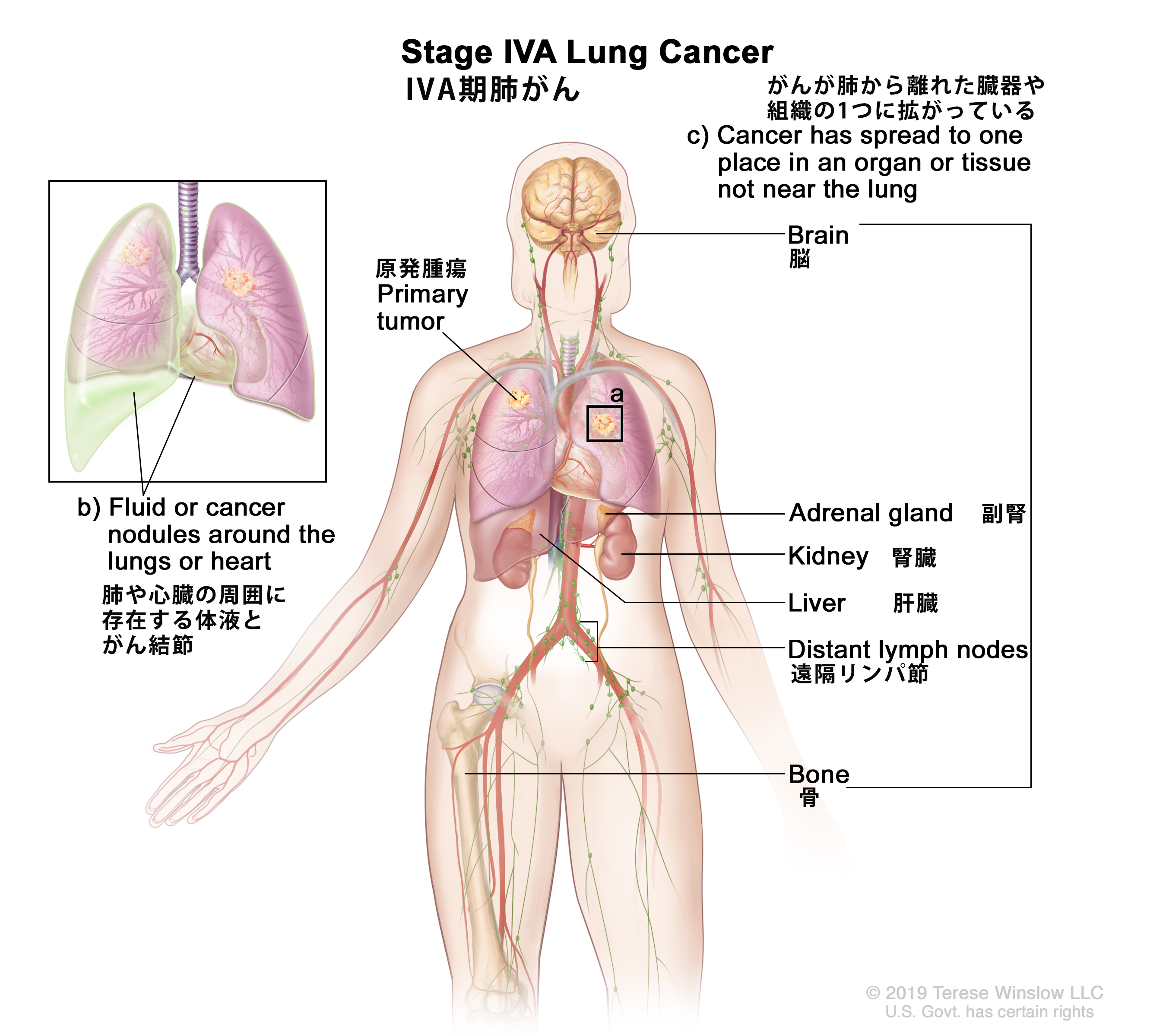 がん情報サイト | がん情報各論：[医療専門家向け]