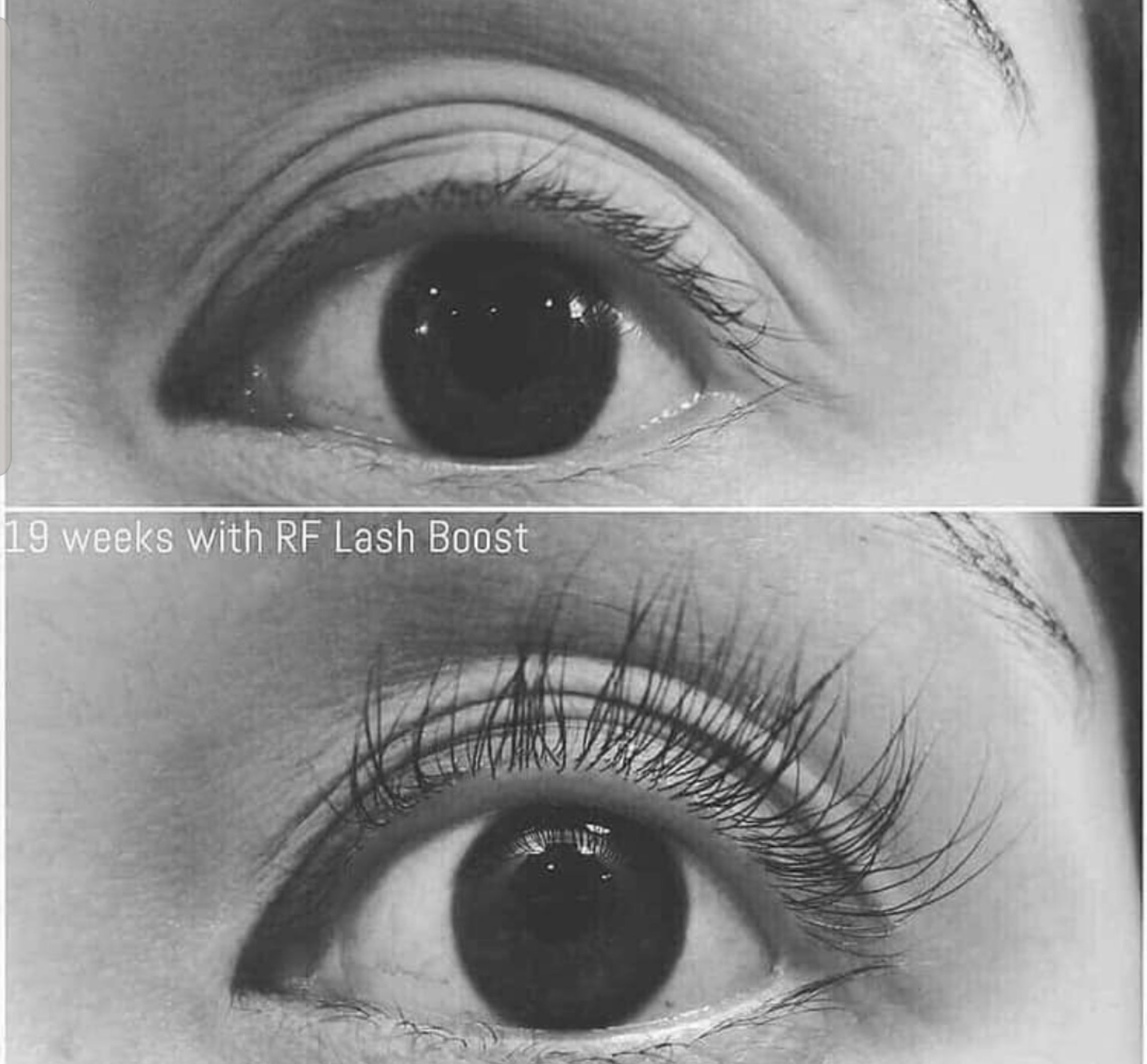 miya☆ロダンアンドフィールズ ラッシュブースト 美容液 人気No.1