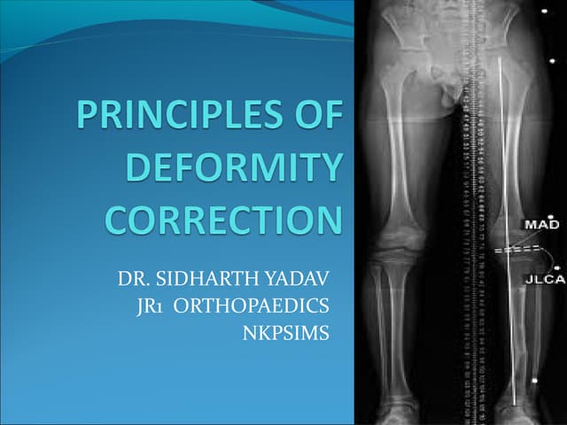 Principles of deformity correction | PPT