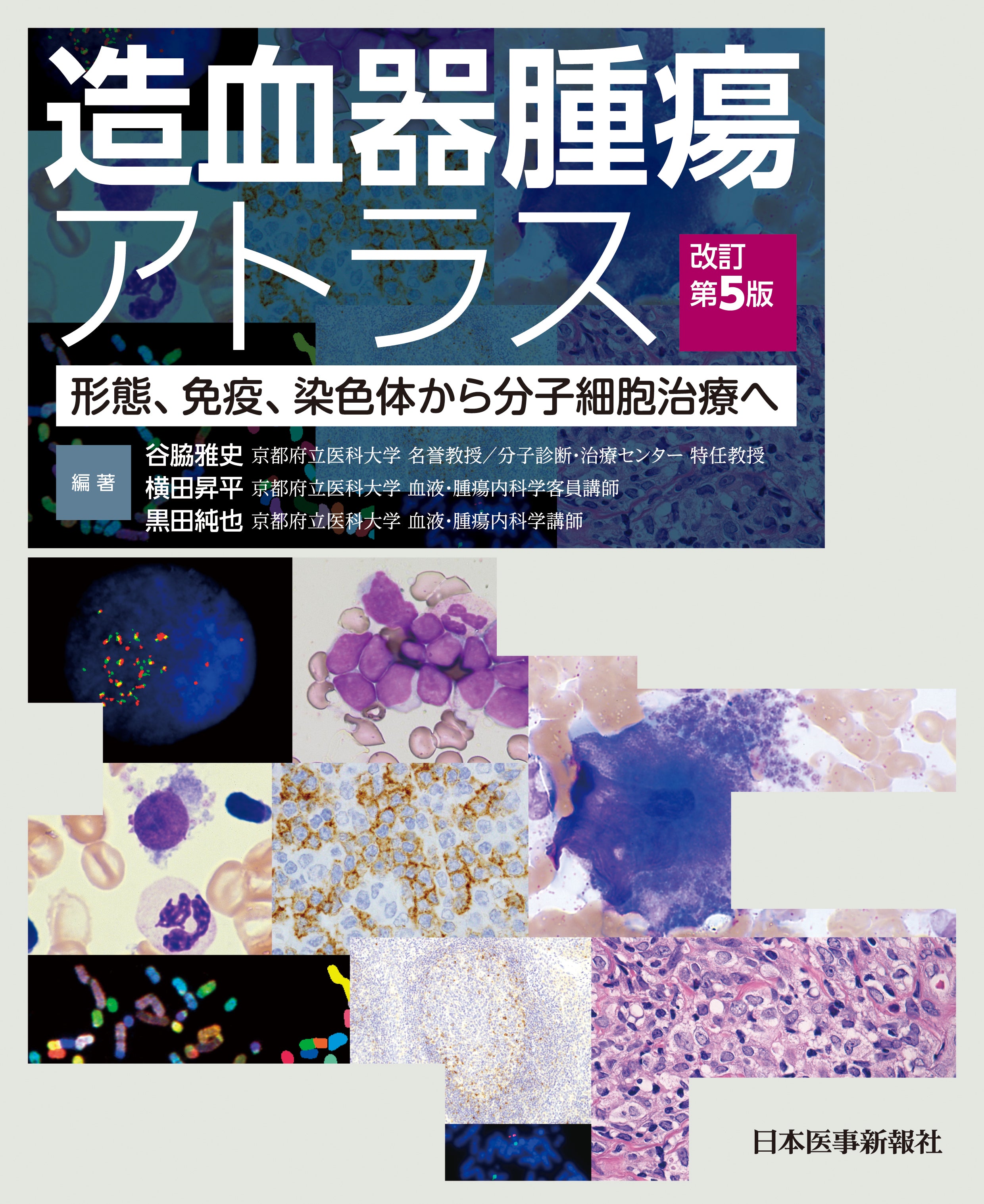 造血器腫瘍アトラス〈第5版〉 – 日本医事新報社