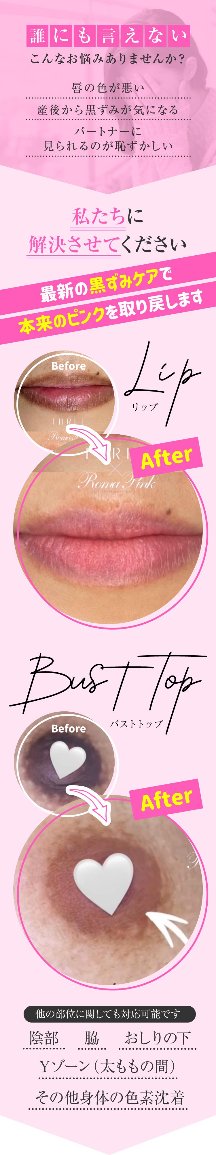 ローマピンク（Roma Pink）｜100％植物由来メラニン除去｜歯の