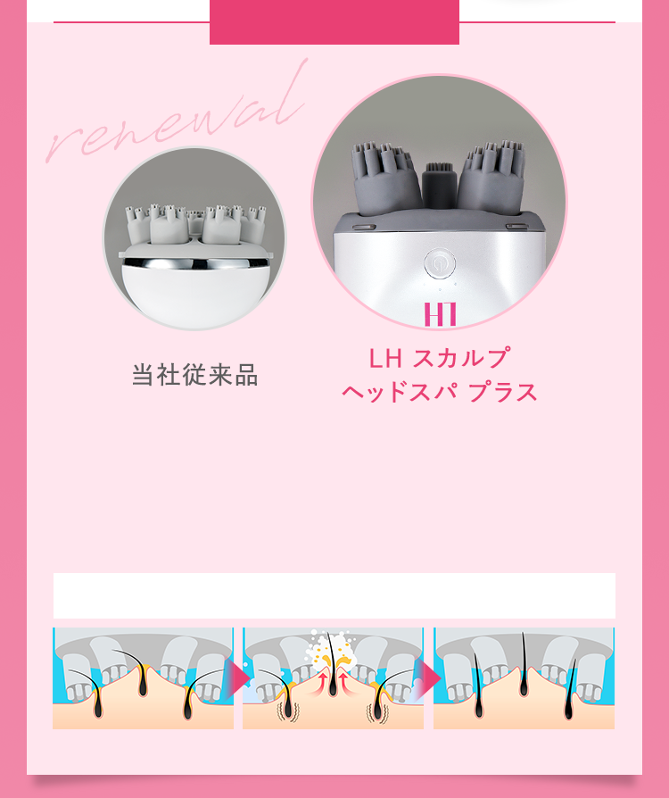 自宅用頭皮マッサージャー】LH スカルプヘッドスパ プラス｜アート