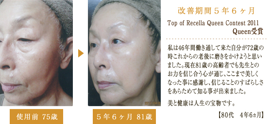 当サロンの症例写真 | 【公式】 Beauty＆Relaxation 心音 (COCON)