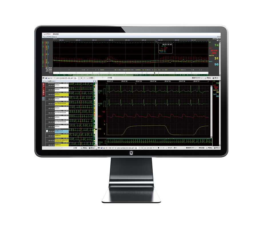 生体モニタ情報システム Prescient® WAVE｜部門システム｜製品情報