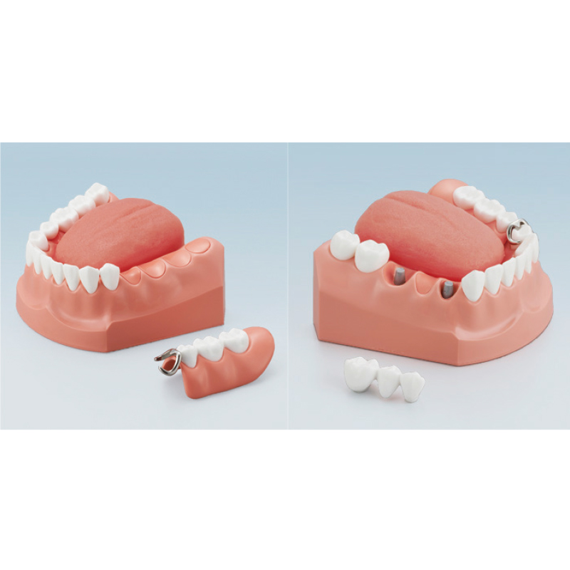 口腔ケア指導顎模型 [ニッシン]の通販 | Ciモール | Ciモール