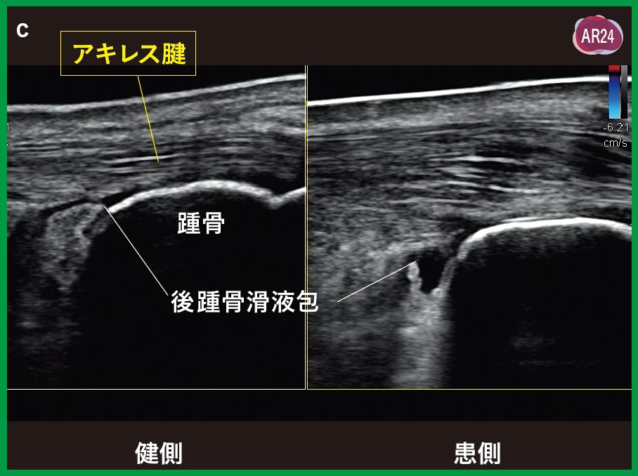運動器エコーのメタ診療｜動画ライブラリ