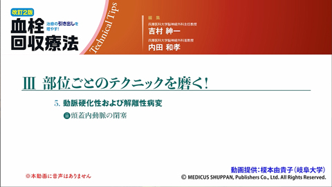 改訂2版 血栓回収療法Technical Tips｜動画ライブラリ