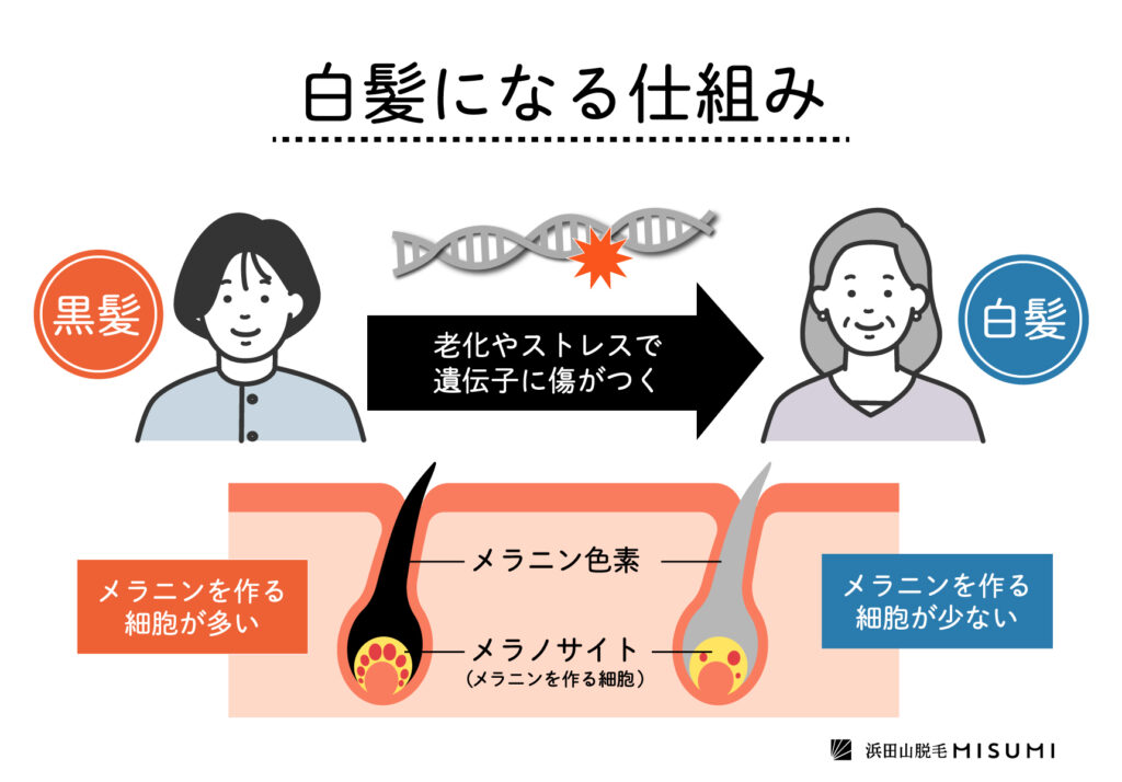 白髪は脱毛できない？その理由と脱毛の仕組みとは – 浜田山脱毛MISUMI