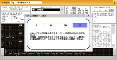 国内初、隠れ心房細動のリスクを推定できるAI機能付き12誘導心電計