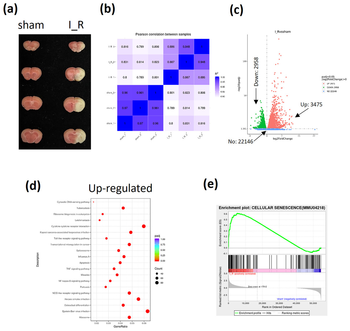 Identification of novel key markers that are induced during