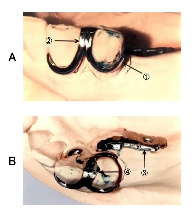 歯科補綴学】以下の文を読み、問いに答えよ。 - 歯科衛生士を目指す