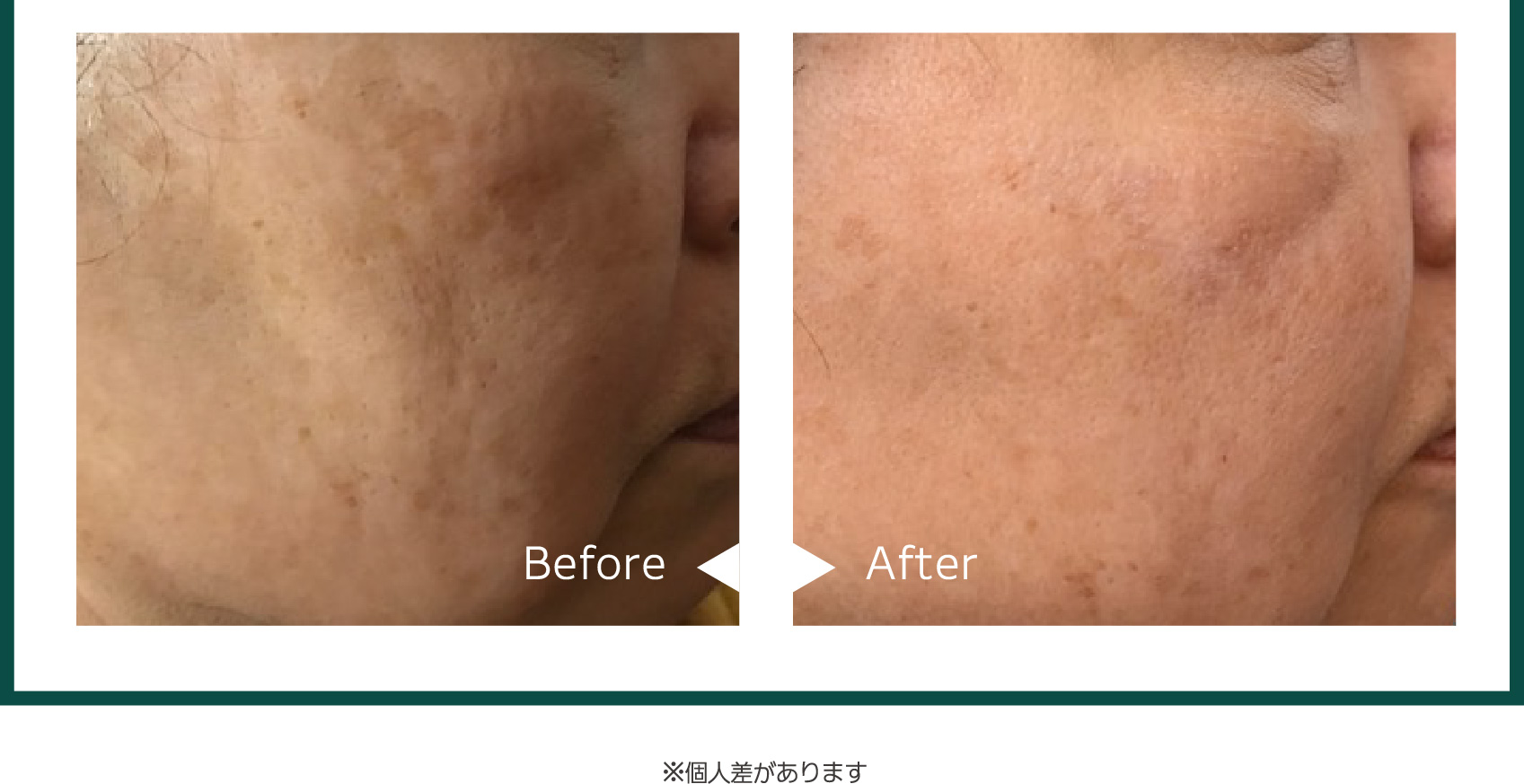 ZAC PACK｜DOC Skincare｜肌のチカラを高め、肌を育む。自宅でできる高