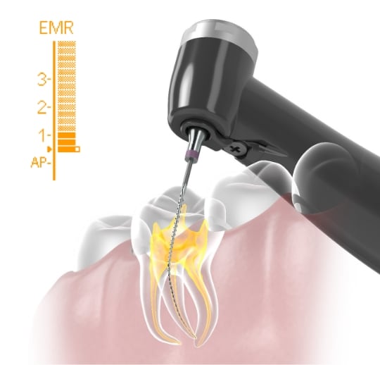 トライオートZX2+（plus）｜オンラインカタログ internet DO【株式会社