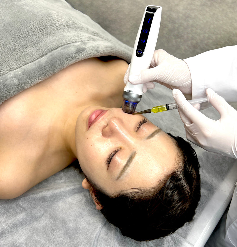 5個セット】レモンボトル(10ml×5バイアル)(脂肪分解剤)