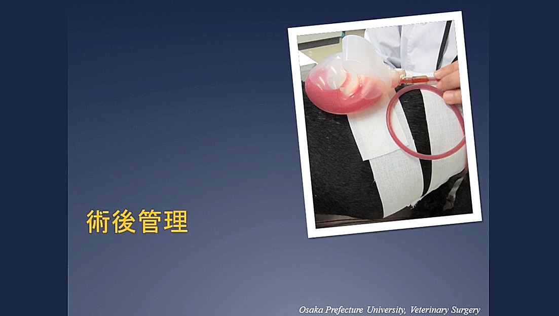 胆嚢摘出術 ② 【胆嚢の外科解剖】｜ETV Store