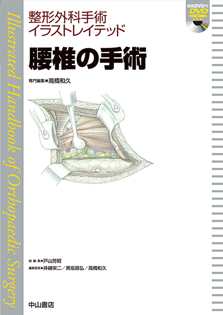 m3電子書籍 | 整形外科手術イラストレイテッド腰椎の手術［動画付き］